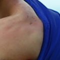FOTOTÕESTUS: "Kannibal" Luis Suarezi seekordne hammustamine ja tema varasemad pahateod