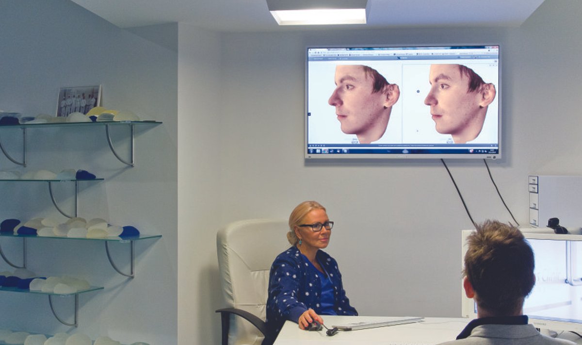 3D simulatsioon patsiendi ninast.