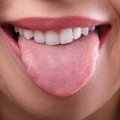 Mis värvi on sinu keel? Muutused suus võivad reeta terviseprobleeme. Millal muutub keel aga mustaks ja karvaseks?